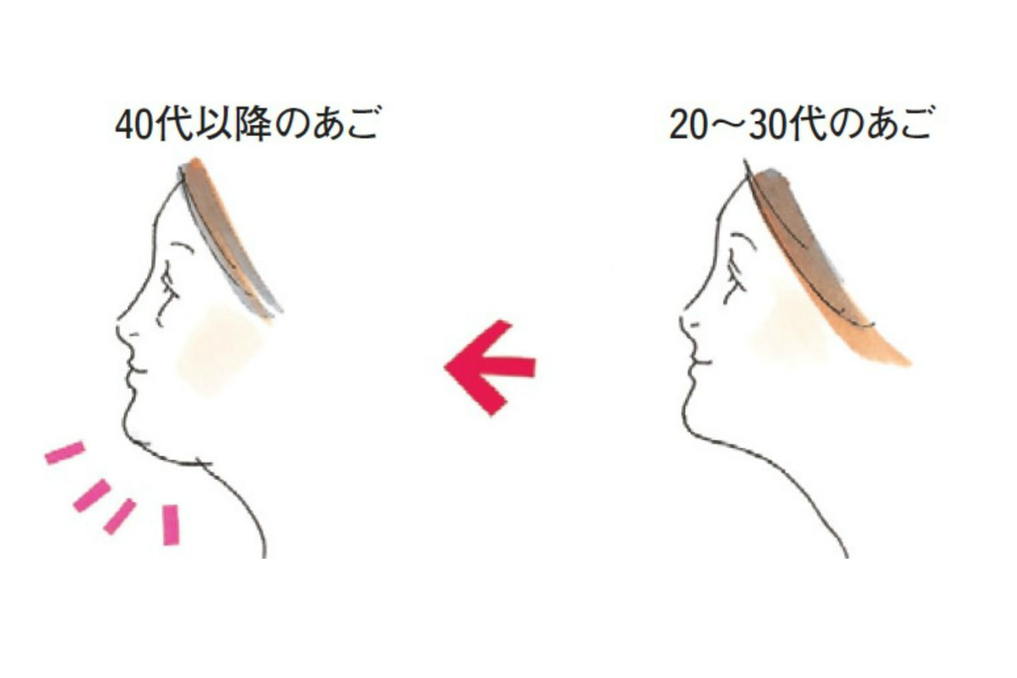 恐怖! 体重は同じでも、表情筋にも開口筋群にもハリがあった20~30代のころ(右)と比べ、40代(左)になると顔の脂肪があご下にたまっていく