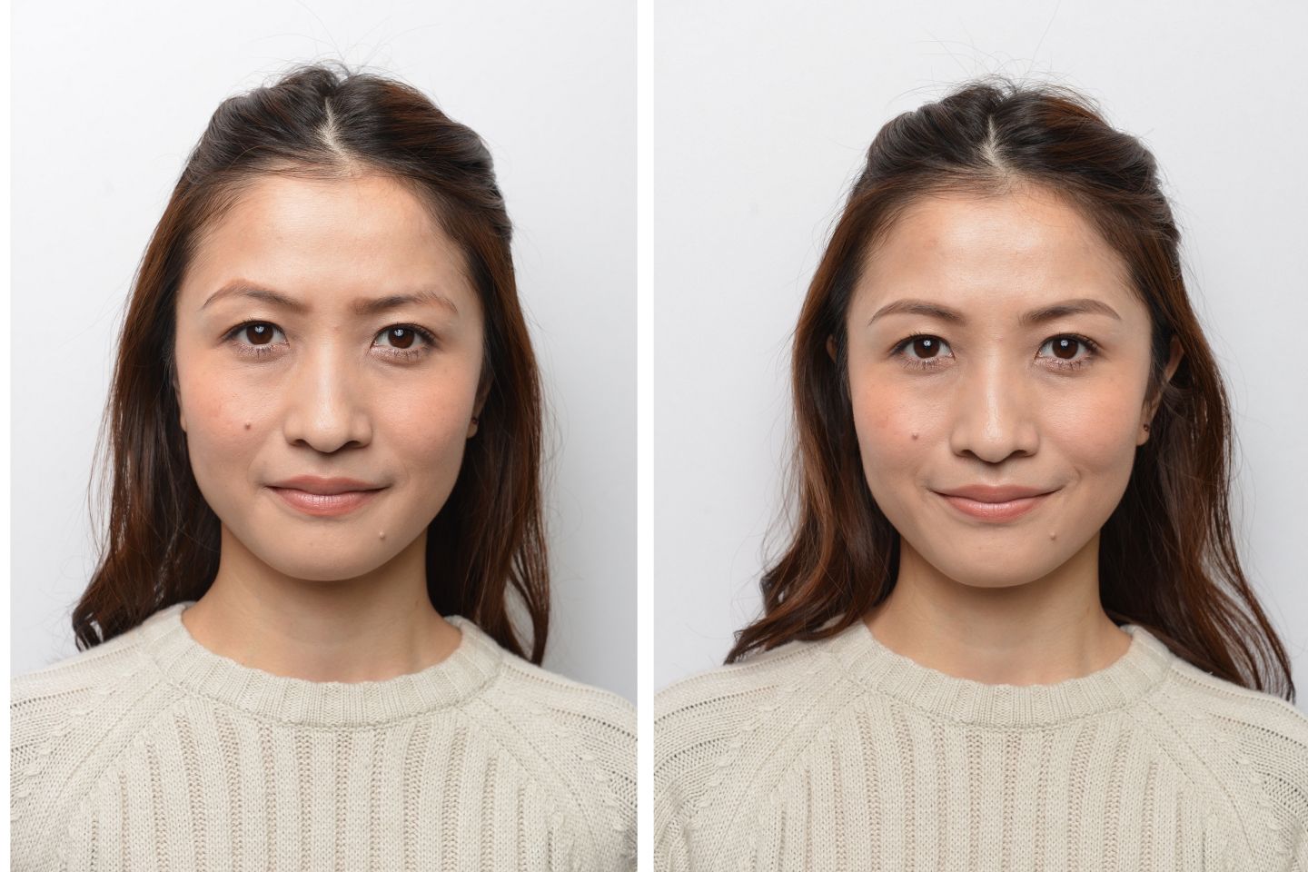 Aさんマスクなしでの施術前と施術後
