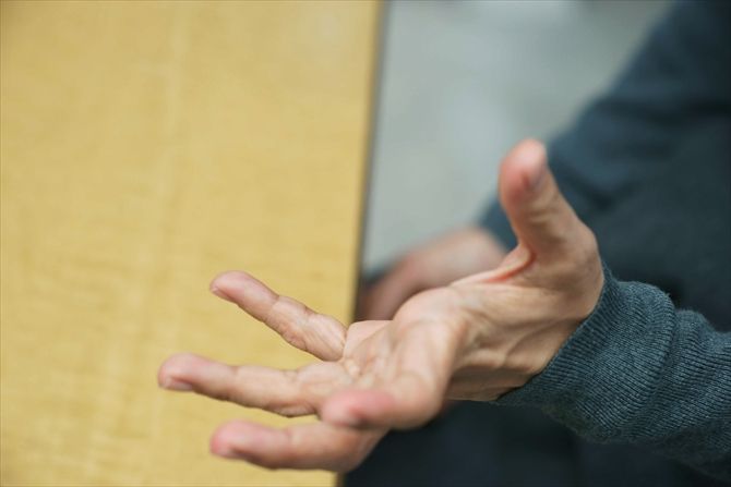 西加奈子さんの手