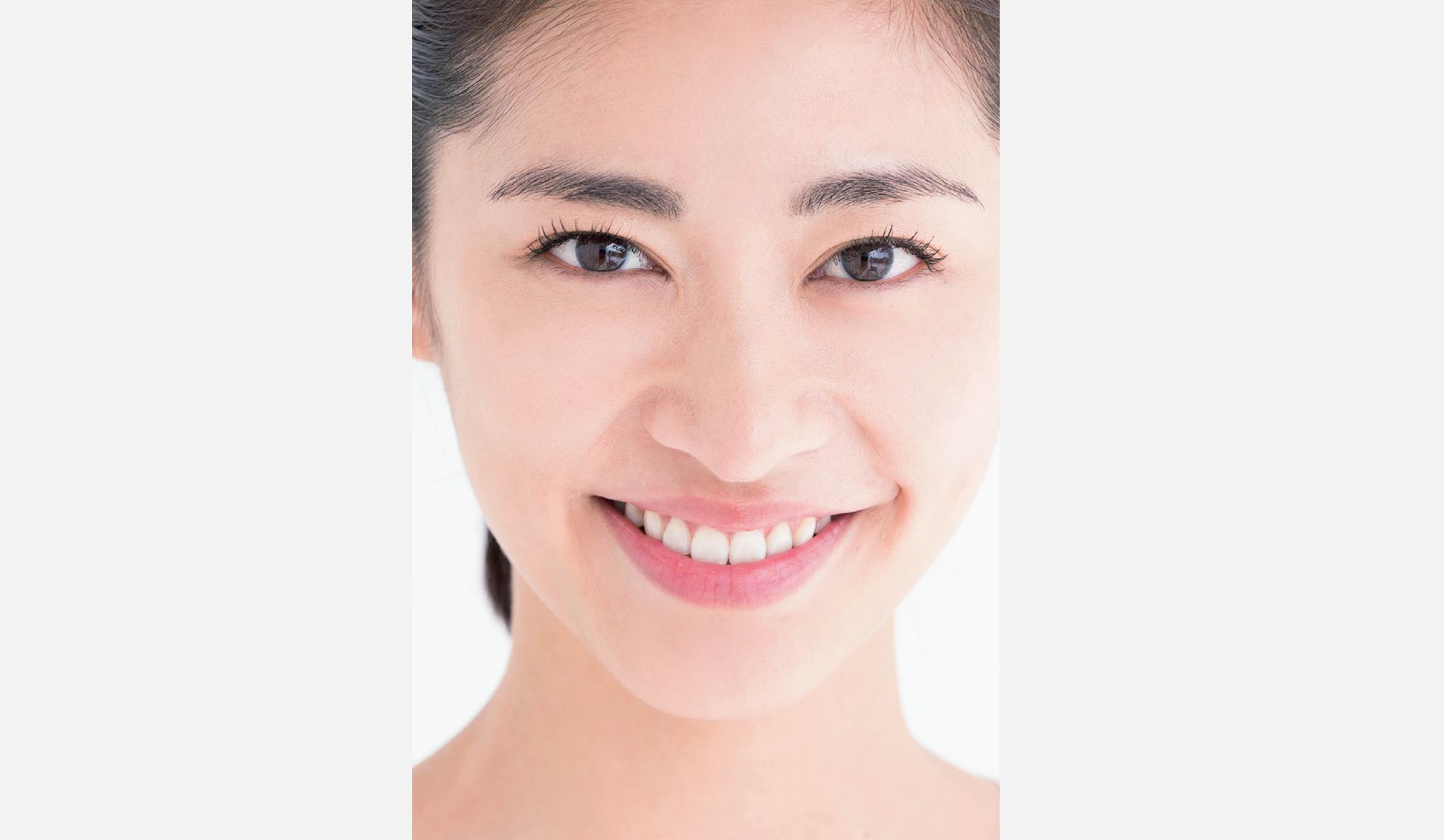 ほうれい線やフェースラインのもたつきが消え、下がり口角がキュッと上向きに