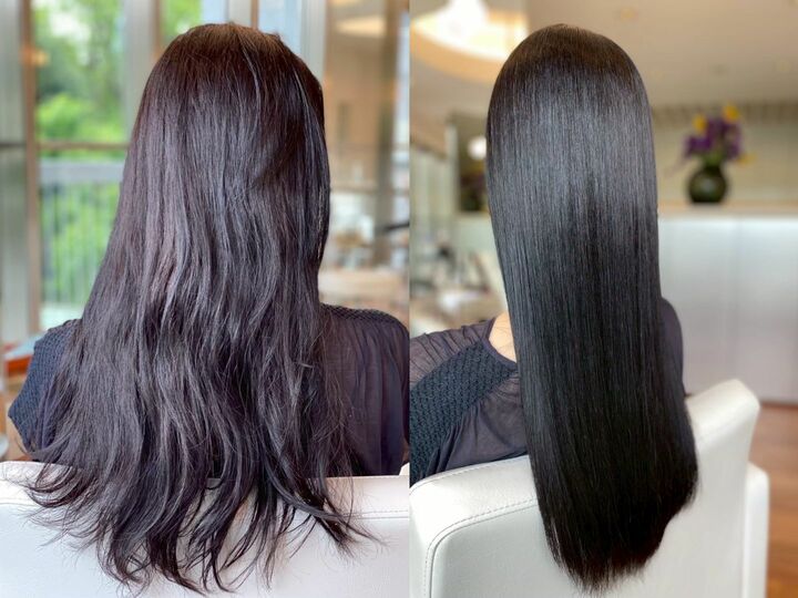 左／施術前　右／“ADMIRE”の施術後　画像提供『AMATA』