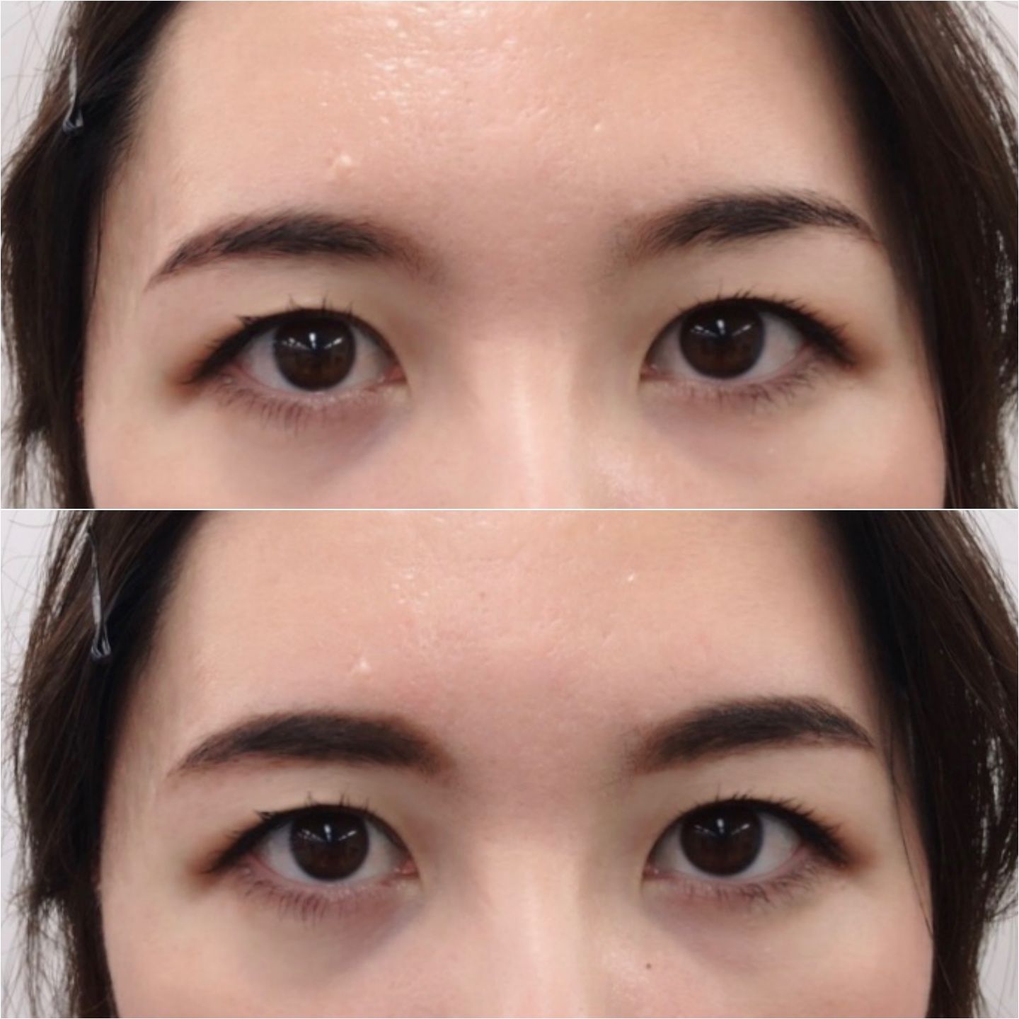 上)Before 下)After