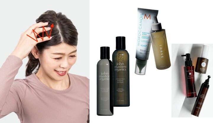 頭のフケ、かゆみの原因と対処法まとめ