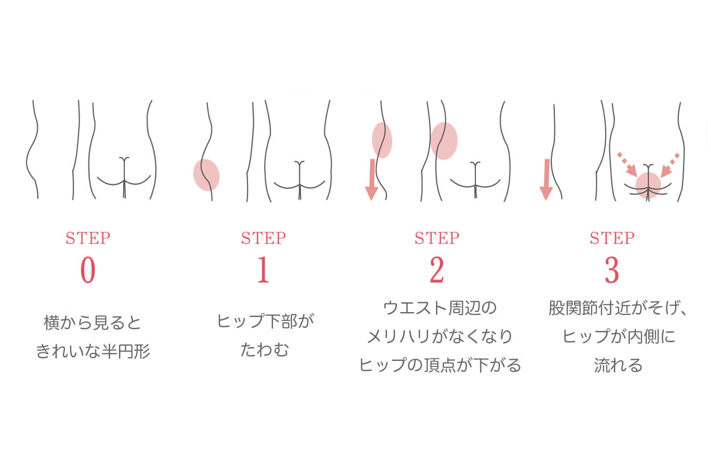 3つのステップで進むおしりのエイジング。脂肪が下がってたれていき、一度ステップが進むと戻りません/画像提供:ワコール