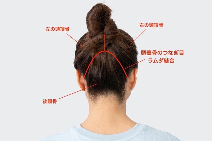 頭蓋骨のつなぎ目「ラムダ縫合」の位置を確認