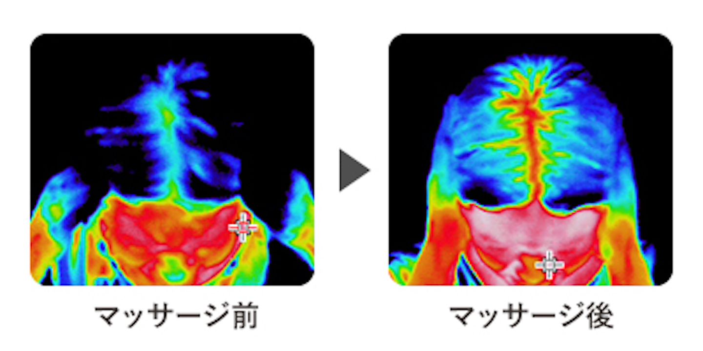 ヘアケア_2,頭皮_2,頭皮