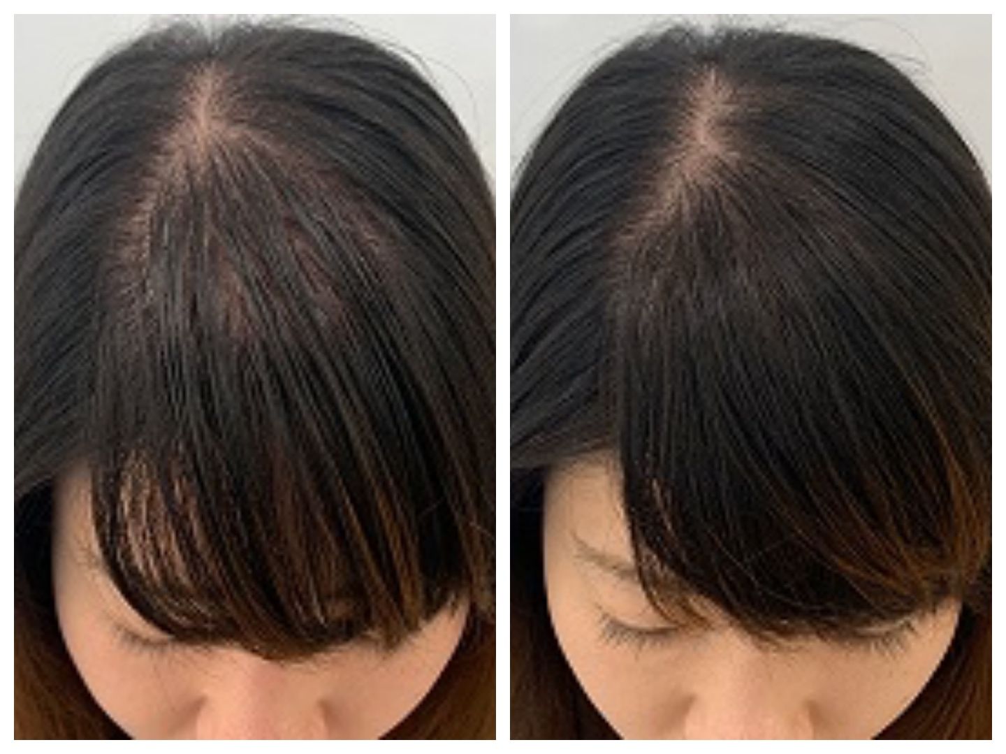 頭皮_1,頭皮ケア_1,ヘアケア_1